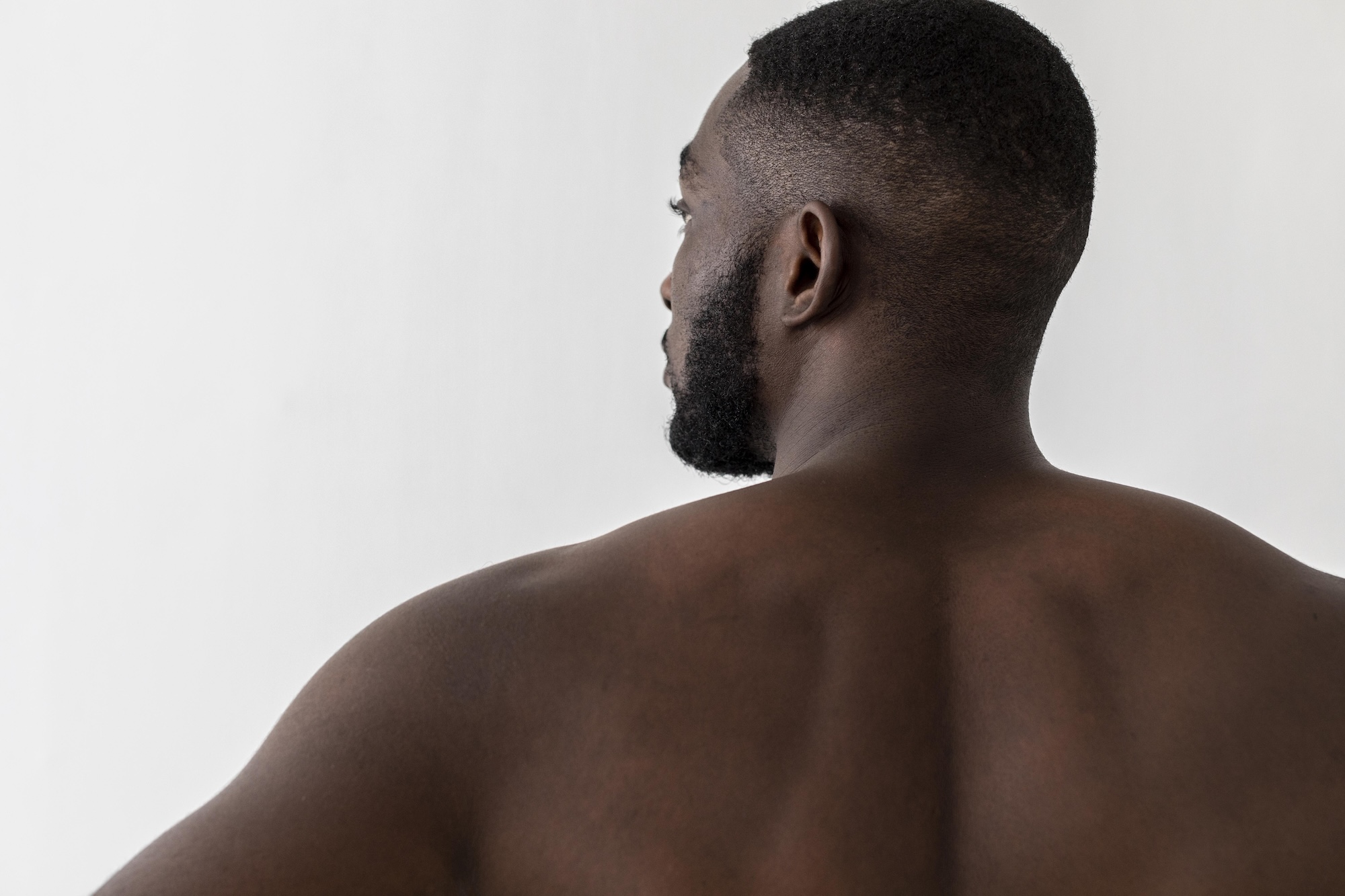 épilation laser homme peau noire efficacité