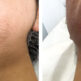 Bleaching laser à Paris : rendez votre duvet invisible sans épilation